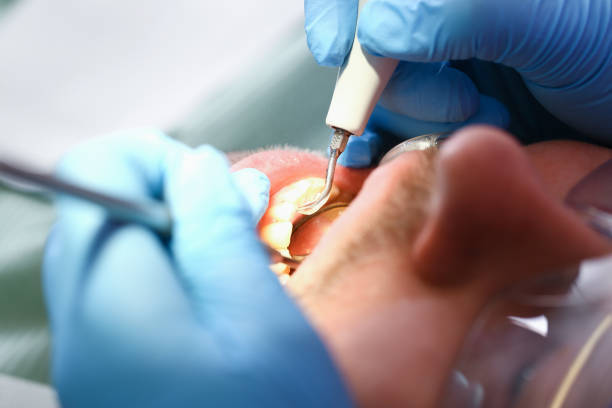 Best Mobile Emergency Dentist in St Leo, FL